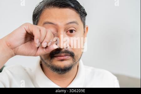 Gros plan homme asiatique souffrant d'yeux irrités avec espace de copie, concept de soins de santé optiques, soins oculaires, allergiques ou démangeaisons ou yeux secs. Banque D'Images
