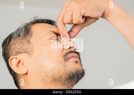Gros plan d'un homme adulte pinçant le pont de son nez, souffrant de sinusite ou d'allergies et problème de rhume des foins. Banque D'Images