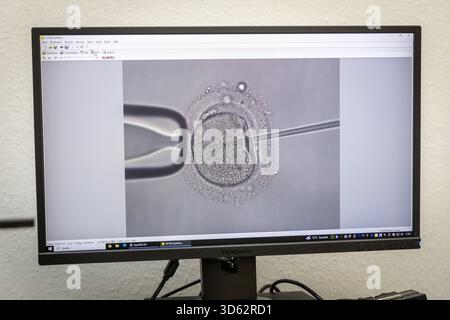 PRODUCTION - 26 septembre 2025, Brême : une image microscopique d'une injection intracytoplasmique de sperme (ICSI), dans laquelle le sperme est injecté dans un ovule à l'aide d'une pipette, peut être vue sur un écran au Kinderwunsch Brême Practice à Brême-Schwachhausen. L'injection intracytoplasmique de spermatozoïdes (ICSI) est l'un des domaines de travail de la pratique. Photo : Focke Strangmann/dpa Banque D'Images