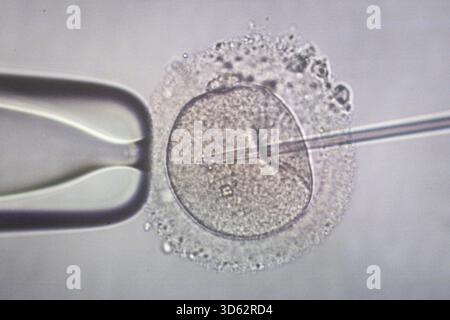 PRODUCTION - 26 septembre 2025, Brême : une image microscopique d'une injection intracytoplasmique de sperme (ICSI), dans laquelle le sperme est injecté dans un ovule à l'aide d'une pipette, peut être vue sur un écran au Kinderwunsch Brême Practice à Brême-Schwachhausen. L'injection intracytoplasmique de spermatozoïdes (ICSI) est l'un des domaines de travail de la pratique. Photo : Focke Strangmann/dpa Banque D'Images