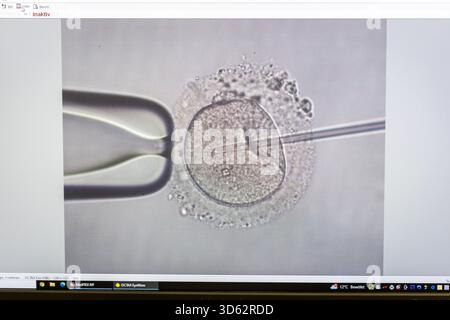 PRODUCTION - 26 septembre 2025, Brême : une image microscopique d'une injection intracytoplasmique de sperme (ICSI), dans laquelle le sperme est injecté dans un ovule à l'aide d'une pipette, peut être vue sur un écran au Kinderwunsch Brême Practice à Brême-Schwachhausen. L'injection intracytoplasmique de spermatozoïdes (ICSI) est l'un des domaines de travail de la pratique. Photo : Focke Strangmann/dpa Banque D'Images