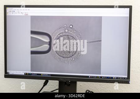 PRODUCTION - 26 septembre 2025, Brême : une image microscopique d'une injection intracytoplasmique de sperme (ICSI), dans laquelle le sperme est injecté dans un ovule à l'aide d'une pipette, peut être vue sur un écran au Kinderwunsch Brême Practice à Brême-Schwachhausen. L'injection intracytoplasmique de spermatozoïdes (ICSI) est l'un des domaines de travail de la pratique. Photo : Focke Strangmann/dpa Banque D'Images