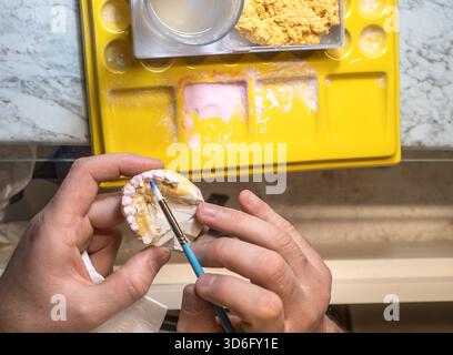 Couronnes dentaires revêtues d'apprêt avant cuisson par technicien en laboratoire, procédé de prosthodontie, préparation céramique, restauration orale, fabrication dentaire. Vue de dessus Banque D'Images