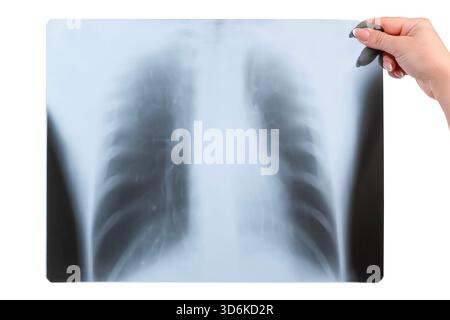 dans une main femelle radiographie des poumons isolée sur fond blanc. Banque D'Images
