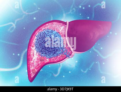 Attaque virale sur le foie humain. illustration 3d. Banque D'Images