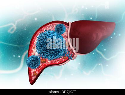Attaque virale sur le foie humain. illustration 3d. Banque D'Images
