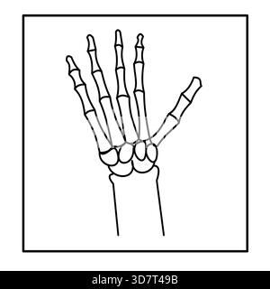 la radiologie des os du doigt de la main, l'icône médicale de la radiologie des os du carpe Illustration de Vecteur