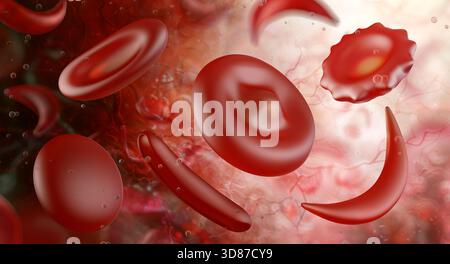 Illustration des formes anormales des érythrocytes (globules rouges), y compris les cellules cibles, les sphérocytes, les ovalocytes, les elliptocytes, drépanocytose et échinocytes. Banque D'Images