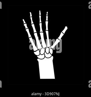 main doigt os x radiographie os carpiens icône médicale noir fond blanc silhouette Illustration de Vecteur