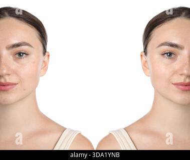 Femme montrant sa peau avant et après le traitement cosmétique. Collage sur fond blanc Banque D'Images