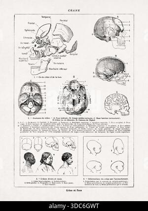 Illustration médicale de Jacques Maurice Dessertenne représentant des crânes et des visages humains d'un ancien dictionnaire français. Banque D'Images