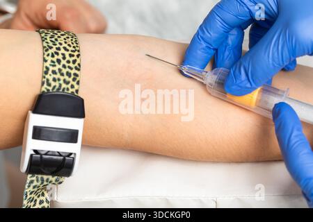 Gros plan d'un travailleur de la santé portant des gants prêts à prélever un échantillon de sang dans la veine du bras avec un vacutainer pendant la procédure de ponction veineuse || modèle libéré Banque D'Images