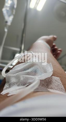 Une prise de vue spectaculaire à faible angle montrant une ligne IV (intraveineuse) insérée dans le bras d'un patient, fixée avec du ruban médical et de la gaze. Dans le ca flou Banque D'Images