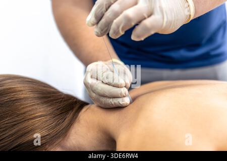 Physiothérapeute effectue l'aiguilletage sec sur le dos de la patiente. Aiguille de récupération. Banque D'Images