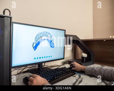 Modélisation dentaire 3D sur écran d'ordinateur avec logiciel CAD CAM pour la conception orthodontique et les prothèses numériques dans le flux de travail moderne des laboratoires dentaires. Banque D'Images