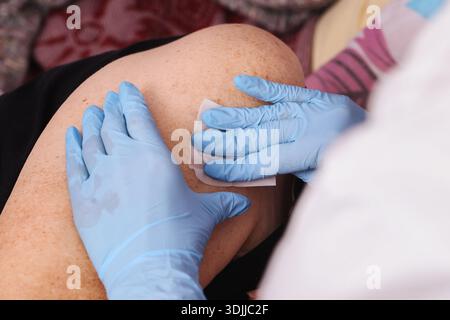 Infirmière désinfectant le bras du patient avant la procédure d'injection. Gros plan de mains gantées préparant la peau à la vaccination ou au traitement médical. Banque D'Images