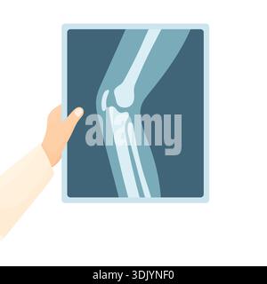 La main d'un médecin dans un manteau blanc tenant une radiographie d'un genou sur un fond blanc. Concept de diagnostic des problèmes osseux ou articulaires du genou. Illustration de Vecteur