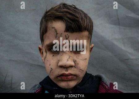ADEM Suleiman Abu Halib, un garçon palestinien de 5 ans qui a perdu 13 parents dans une frappe israélienne contre sa maison du camp de Nuseirat, est vu dans la bande de Gaza le 19 janvier 2026. Aveuglé par des éclats d'obus au visage, il vit maintenant dans une tente dans le camp avec son oncle, luttant pour survivre. (Photo par Abood Abusalama/Middle East images/StringersHub/SIPA USA) Banque D'Images