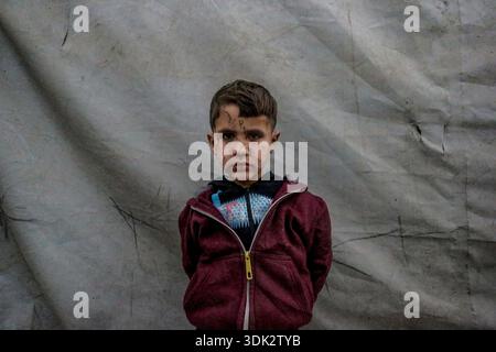 ADEM Suleiman Abu Halib, un garçon palestinien de 5 ans qui a perdu 13 parents dans une frappe israélienne contre sa maison du camp de Nuseirat, est vu dans la bande de Gaza le 19 janvier 2026. Aveuglé par des éclats d'obus au visage, il vit maintenant dans une tente dans le camp avec son oncle, luttant pour survivre. (Photo par Abood Abusalama/Middle East images/StringersHub/SIPA USA) Banque D'Images