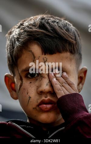ADEM Suleiman Abu Halib, un garçon palestinien de 5 ans qui a perdu 13 parents dans une frappe israélienne contre sa maison du camp de Nuseirat, est vu dans la bande de Gaza le 19 janvier 2026. Aveuglé par des éclats d'obus au visage, il vit maintenant dans une tente dans le camp avec son oncle, luttant pour survivre. (Photo Saeed Jaras/Middle East images/StringersHub/SIPA USA) Banque D'Images