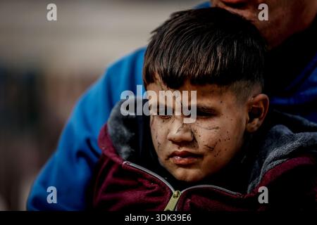 ADEM Suleiman Abu Halib, un garçon palestinien de 5 ans qui a perdu 13 parents dans une frappe israélienne contre sa maison du camp de Nuseirat, est vu dans la bande de Gaza le 19 janvier 2026. Aveuglé par des éclats d'obus au visage, il vit maintenant dans une tente dans le camp avec son oncle, luttant pour survivre. (Photo Saeed Jaras/Middle East images/StringersHub/SIPA USA) Banque D'Images