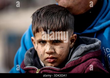 ADEM Suleiman Abu Halib, un garçon palestinien de 5 ans qui a perdu 13 parents dans une frappe israélienne contre sa maison du camp de Nuseirat, est vu dans la bande de Gaza le 19 janvier 2026. Aveuglé par des éclats d'obus au visage, il vit maintenant dans une tente dans le camp avec son oncle, luttant pour survivre. (Photo Saeed Jaras/Middle East images/StringersHub/SIPA USA) Banque D'Images
