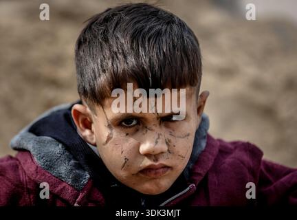 ADEM Suleiman Abu Halib, un garçon palestinien de 5 ans qui a perdu 13 parents dans une frappe israélienne contre sa maison du camp de Nuseirat, est vu dans la bande de Gaza le 19 janvier 2026. Aveuglé par des éclats d'obus au visage, il vit maintenant dans une tente dans le camp avec son oncle, luttant pour survivre. (Photo Saeed Jaras/Middle East images/StringersHub/SIPA USA) Banque D'Images