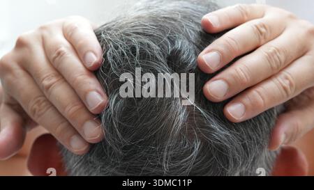 Cheveux blancs et cheveux gris de l'homme, problèmes de santé des cheveux avec perte de cheveux et amincissement. Banque D'Images