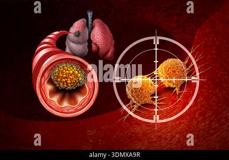 Traitement du cancer du poumon et cancers du poumon à petites cellules comme une tumeur maligne centrale croissance comme une métastase se développant dans les poumons à partir d'une bronche comme une bronche Banque D'Images