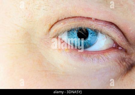 Gros plan extrême d'un œil humain bleu vif avec texture de peau et cils visibles Banque D'Images