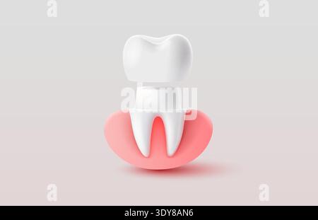 Illustration de couronne dentaire en 3D avec la gencive et la structure des dents, représentant la santé dentaire. Illustration vectorielle. Illustration de Vecteur