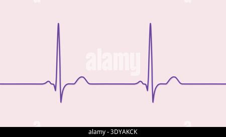 Normal Stable Illustration d'un électrocardiogramme (ECG) normal, montrant un rythme ...