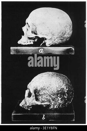 Le crâne d'homme tamoul et le crâne d'Aditanallur font référence à des spécimens crâniens anthropologiques associés à l'Inde du Sud. Aditanallur dans le Tamil Nadu est un site archéologique connu pour les sépultures de l'âge du fer et les restes squelettiques découverts lors de fouilles. Edgar Thurston (1855-1935), conservateur du Musée du gouvernement de Madras, a inclus des illustrations crâniennes comparatives dans castes and Tribes of Southern India (1909). L'image d'archives enregistre une illustration photographique utilisée pour la comparaison anthropologique. Banque D'Images