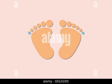 Illustration conceptuelle des pieds polydactyles. Il s'agit d'une condition congénitale où un bébé naît avec un doigt supplémentaire (orteil). Le traitement implique habituellement une excision chirurgicale pour des raisons fonctionnelles et esthétiques. Banque D'Images