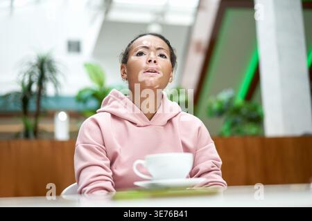 Noire africaine américaine femme avec vitiligo pigmentation problème de peau intérieur habillé rose hoodie Banque D'Images