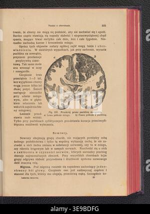 Jenny Springer (active dans les années 1920) était une auteure polonaise et éducatrice en santé. Le tirage photographique historique enregistre son œuvre de 1928 Lekarka domowa, qui offre des conseils complets sur la santé domestique et les soins pour les malades et en bonne santé. Banque D'Images