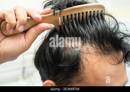 Chauve à l'avant de la tête et commencer aucune perte de cheveux glabre de l'homme de bureau actif intelligent d'affaires asiatique mature. Banque D'Images