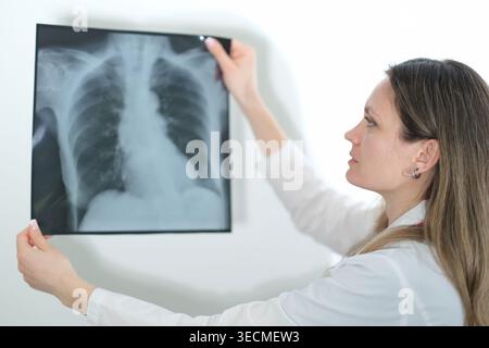 Radiologue caucasienne examinant la radiographie thoracique Banque D'Images
