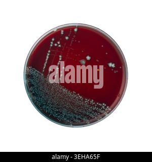 Culture mixte de Pichia kudriavzevii, Candida albicans et Lactobacillus delbrueckii sur boîte de Pétri gélose au sang (identifiée comme MALDI TOF) Banque D'Images