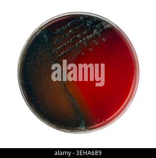 Culture pure de souche de Pseudomonas aeruginosa à brillance métallique et hémolyse sur boîte de Pétri gélose au sang Banque D'Images