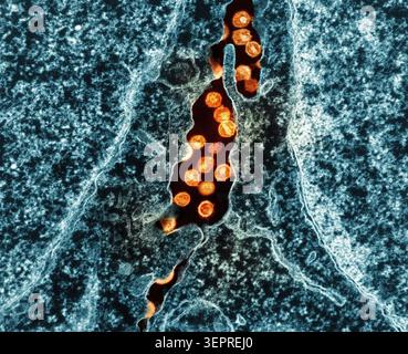 Virus VIH-1, TEM Banque D'Images