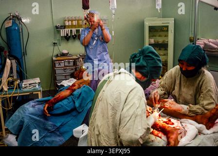 Hôpital du CICR, Kaboul (Afghanistan), août 1992 ; des chirurgiens opèrent sur une nouvelle victime de mines terrestres. Après 14 ans de guerre, le comté est un champ de mines, avec plus de 56 000 amputés. Banque D'Images