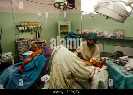 Hôpital du CICR, Kaboul (Afghanistan), août 1992 ; des chirurgiens opèrent sur une nouvelle victime de mines terrestres. Après 14 ans de guerre, le comté est un champ de mines, avec plus de 56 000 amputés. Banque D'Images