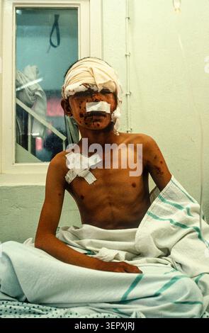 Hôpital du CICR, Kaboul (Afghanistan), août 1992 ; amputés en phase de rétablissement post-opératoire. Après 14 ans de guerre, le comté est un champ de mines, avec plus de 56 000 amputés. Banque D'Images