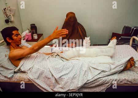 Hôpital du CICR, Kaboul, Afghanistan, août 1992 ; enfants blessés lors de combats récents au cours de 3 jours d'attaques à la roquette sur la capitale. Banque D'Images