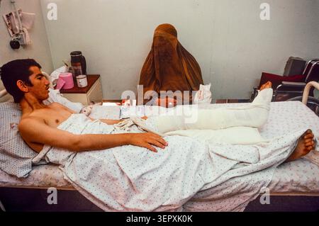 Hôpital du CICR, Kaboul, Afghanistan, août 1992 ; enfants blessés lors de combats récents au cours de 3 jours d'attaques à la roquette sur la capitale. Banque D'Images
