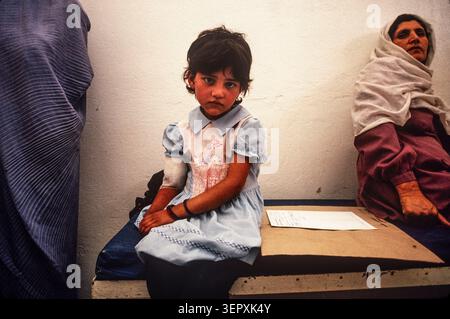 Hôpital du CICR, Kaboul, Afghanistan, août 1992 ; enfants blessés lors de combats récents au cours de 3 jours d'attaques à la roquette sur la capitale. Banque D'Images