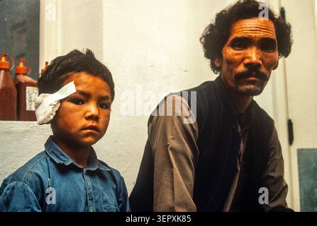 Hôpital du CICR, Kaboul, Afghanistan, août 1992 ; enfants blessés lors de combats récents au cours de 3 jours d'attaques à la roquette sur la capitale. Banque D'Images