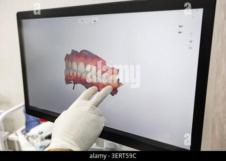 Dentiste pointant le modèle dentaire 3D sur écran d'ordinateur dans la clinique moderne Banque D'Images