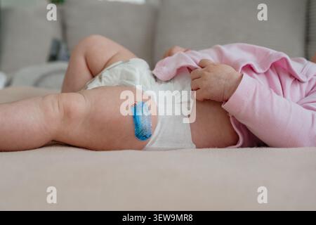 Un nouveau-né dans une couche et un dessus rose couché sur une couverture beige, avec un pansement médical bleu vif imprimé adhésif visible sur le haut de la cuisse Banque D'Images